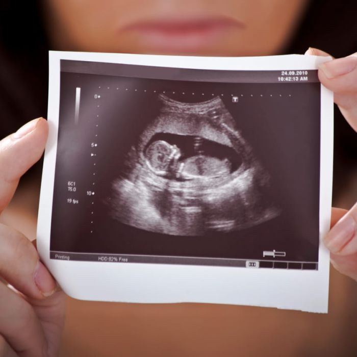 Abortus - slaan we door?